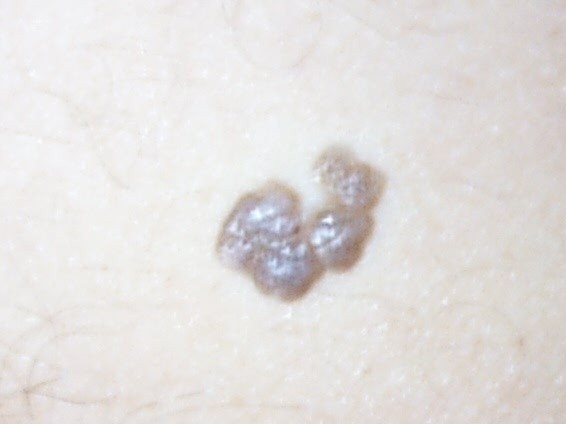molejun13b.jpg